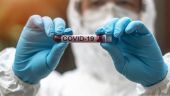 ΠΟΥ: Η Covid-19 εξακολουθεί να προκαλεί 1.700 θανάτους την εβδομάδα